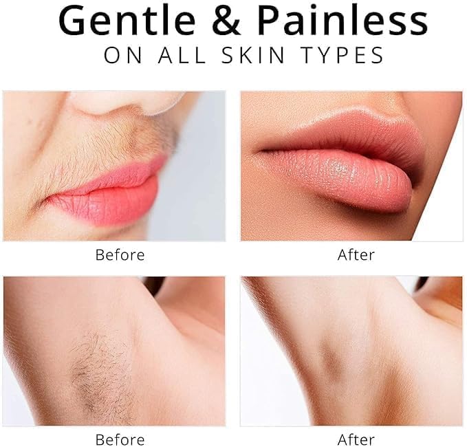 Rechargeable Facial Hair Remover – Gentle, Painless,Precision Shaver & Travel-Friendly for Women